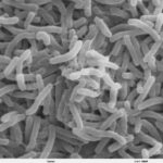 Cholera_bacteria_SEM