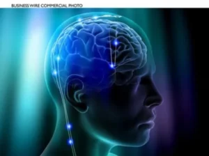 التحفيز العميق للدماغ هو إجراء جراحي عصبي يستهدف أماكن معينة في الدماغ (أسوشيتد برس)